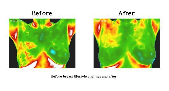 Rebalance Breast Thermography near Me Rebalance Breast Thermography near Me